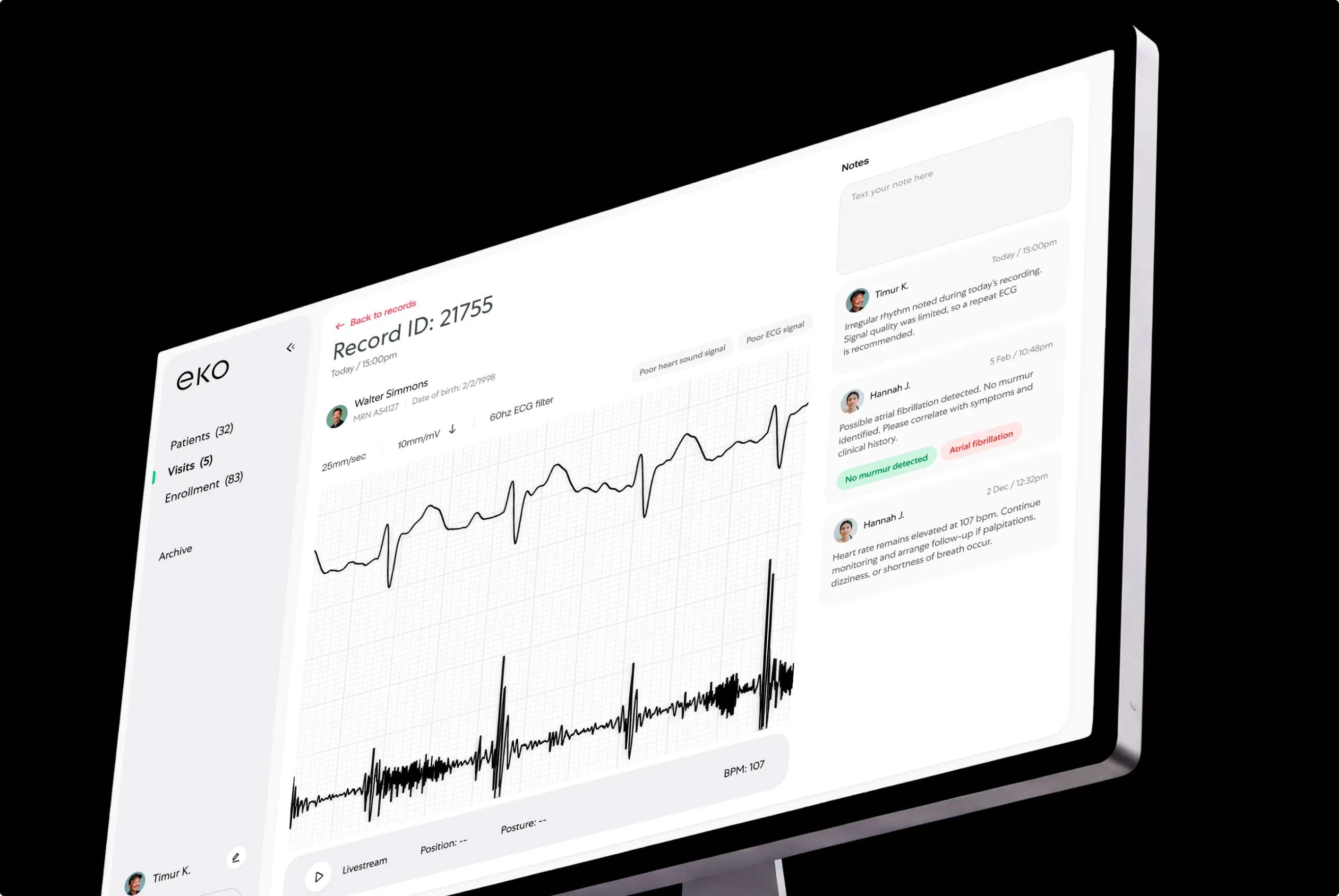 Angled desktop monitor showing the Eko Record ID 21755 ECG detail view with waveform and a clinician notes panel, on black